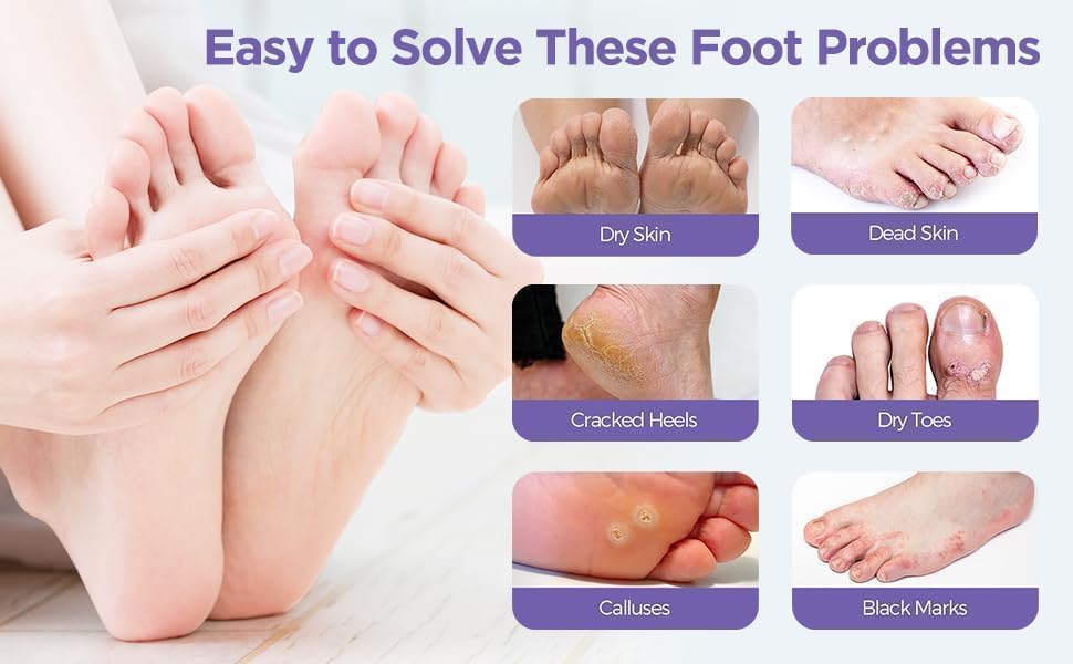 Exfoliating Foot Mask Goat Milk