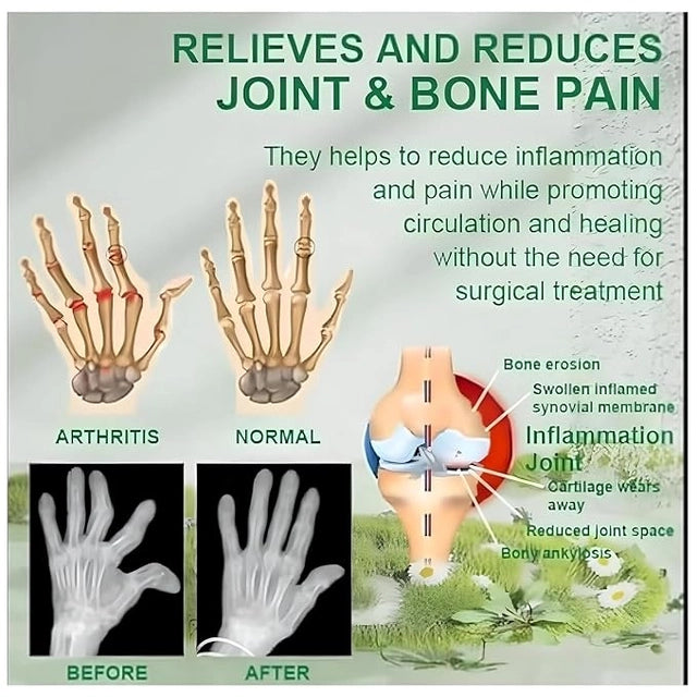 Joint and Bone Therapy Cream | Pain Relief Cream